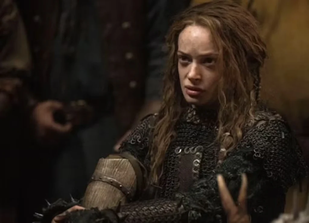 Atriz de Como Treinar o Seu Dragão revela amputação da segunda perna Atriz de Como Treinar o Seu Dragão revela amputação da segunda perna