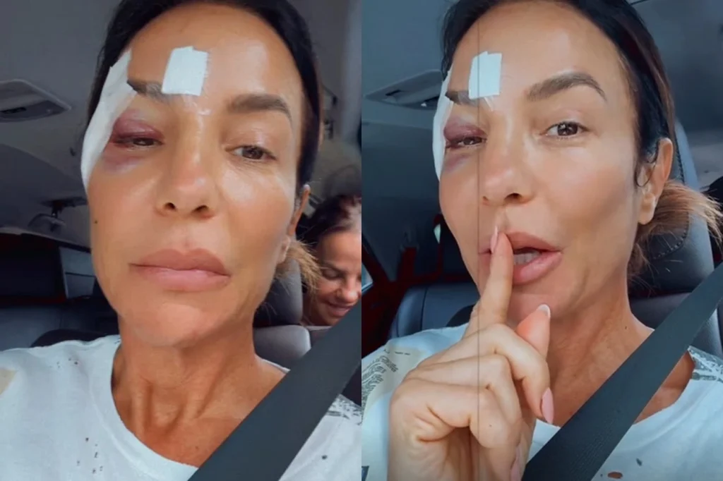 Ivete Sangalo luta contra desmaio e diagnose grave após momentos de aflição em Salvador, agora está melhor Ivete Sangalo luta contra desmaio e diagnose grave após momentos de aflição em Salvador, agora está melhor