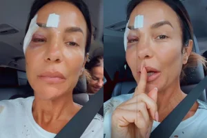 Ivete Sangalo luta contra desmaio e diagnose grave após momentos de aflição em Salvador, agora está melhor