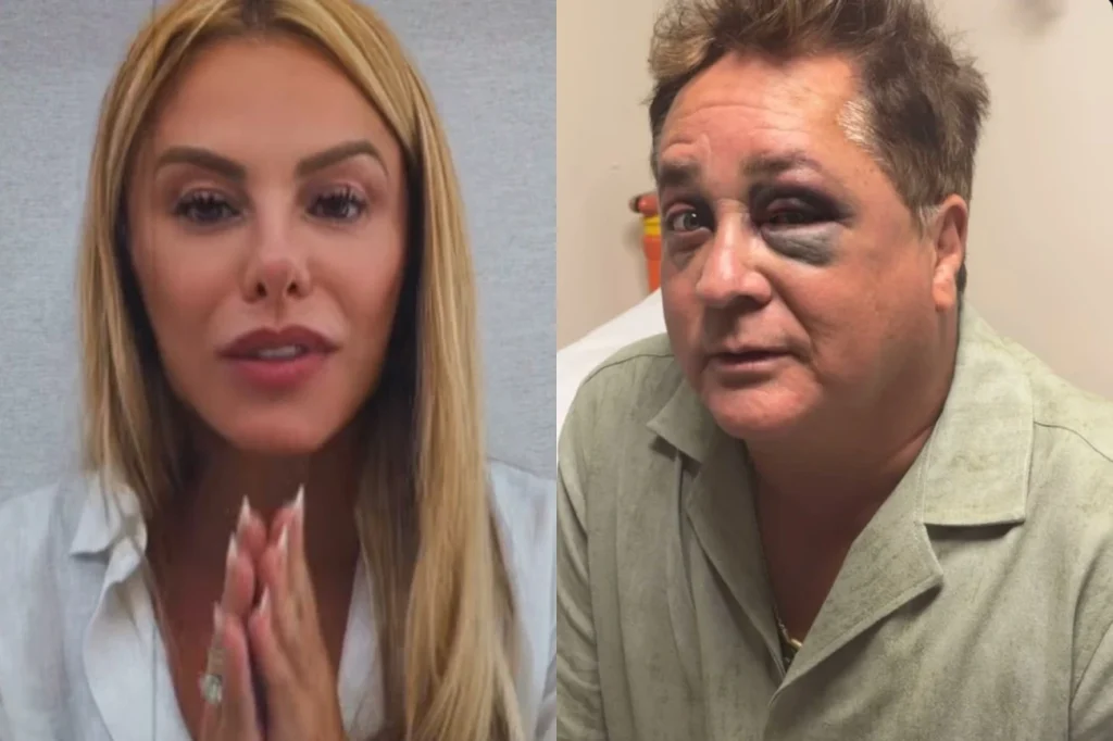 Poliana Rocha tranquiliza fãs sobre estado de saúde de Leonardo após tombo